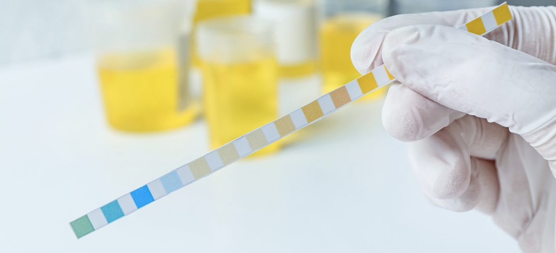 Un un test rapide d’orientation diagnostique (Trod) réalisé en pharmacie permet de déterminer qu'il s'agit bien d'une infection urinaire.