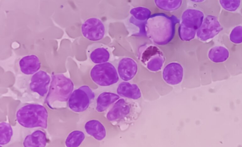 Des chercheurs ont mis au point une stratégie innovante d’immunothérapie capable de déclencher une réponse immunitaire et détruire les cellules cancéreuses. Après des résultats concluants chez la souris, des recherches supplémentaires seront nécessaires afin d’en évaluer l’efficacité chez l’être humain.