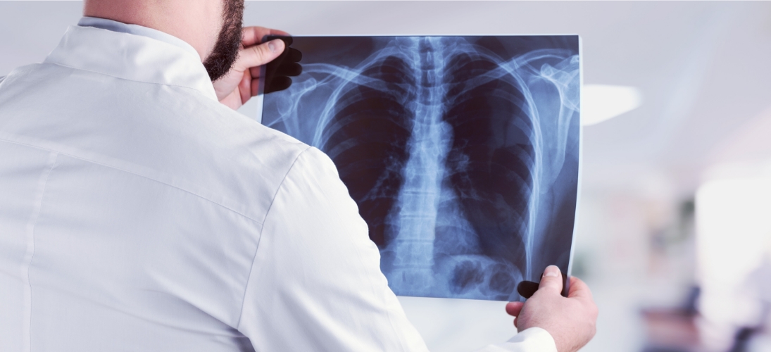 Comment se protéger des infections respiratoires aiguës ?