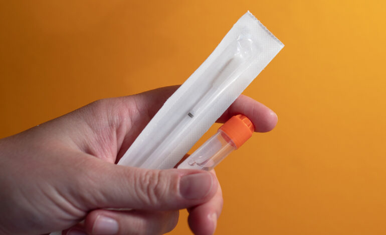 Le Conseil économique, social et environnement lance le débat autour des tests génétiques qui promettent d’en savoir plus sur ces origines.