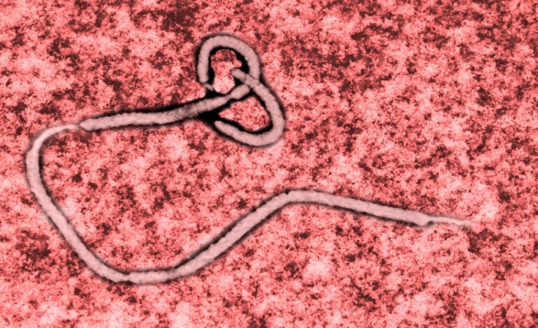L'épidémie de fièvre hémorragique à virus Ebola sévit en République démocratique du Congo. Voici les points clés à connaître.