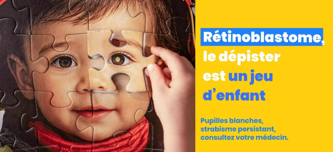 Rétinoblastome : mieux repérer le cancer de la rétine chez l’enfant