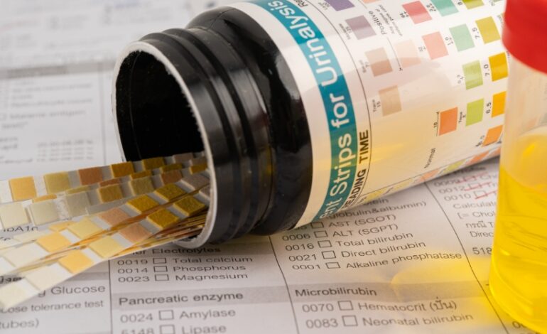 L'Assurance maladie étend aux hommes de 18 à 25 ans l'accès gratuit aux kits de dépistage à domicile de la chlamydia et de la gonorrhée. Cette mesure vise à faciliter la détection précoce de ces infections sexuellement transmissibles (IST), qui peuvent avoir des répercussions néfastes sur la santé.